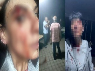 Esenyurt’ta kadına şiddet: 2 kişi tutuklandı